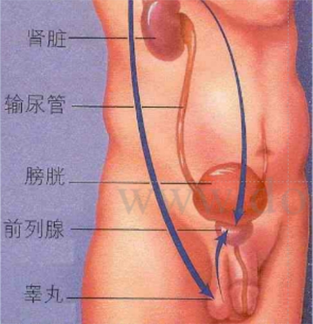 前列腺增生治疗进展